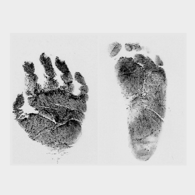 Photo de Malo DUPUIS